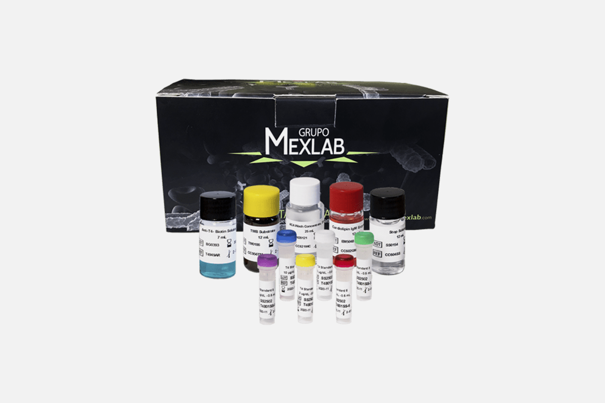 Inmunoensayo enzimático para la detección cualitativa de Toxoplasma Gondii IgM en suero o plasma | 6001209 TOXO IgM