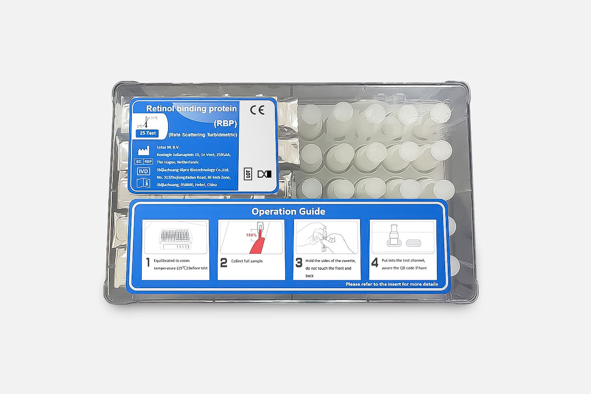 Kit de prueba de proteína cegadora de retinol (Método turbidimétrico de dispersión de velocidad) | 1111014 Retinol (Método turbidimétrico)