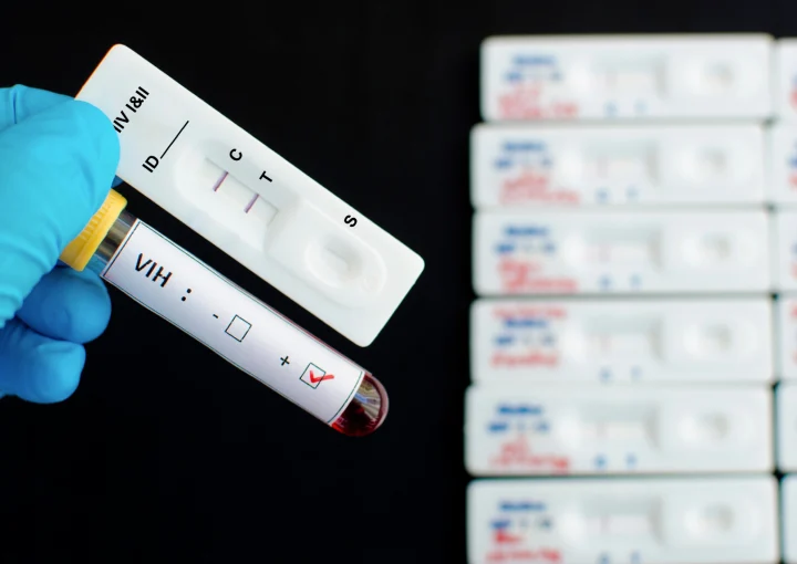 Prueba-rápida-VIH-Diagnóstico-eficiente