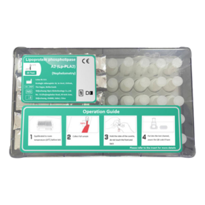 Nefelometría cuantitativa (Lp-PLA2) Lipoproteína Fosfolipasa A2