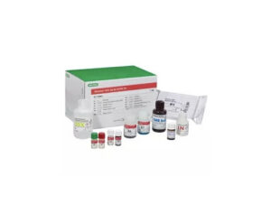 MONOLISA Ag-Ab HCV ULTRA V2