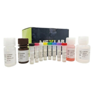 ELISA Gonadotropina Coriónica Humana (HCG)