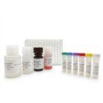 ELISA (N-17-OHP) Progesterona Neonatal