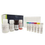 ELISA (Anti-Tg) Anti-Tiroglobulina