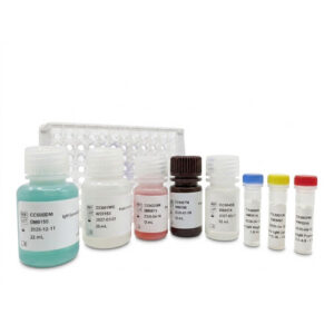 ELISA Citomegalovirus (CMV) IgG